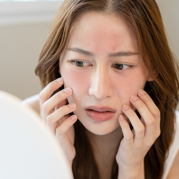 Soothing care for sensitive skin By BNB Derma