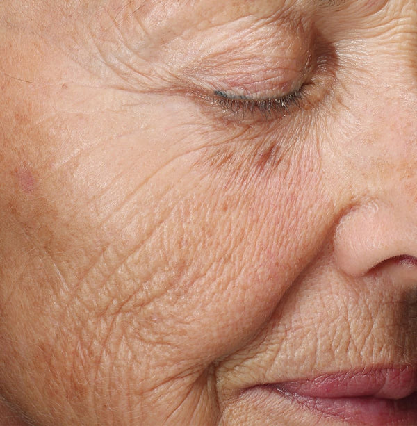 Best anti-aging skincare for wrinkles in Pakistan | B&B Derma