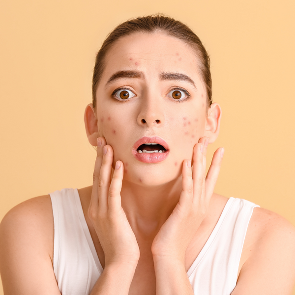 Moisturizer for skin hydration- By BnB Derma 