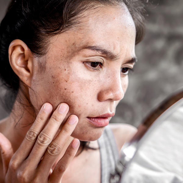 Skincare for dark spots and pigmentation By BNB Derma 