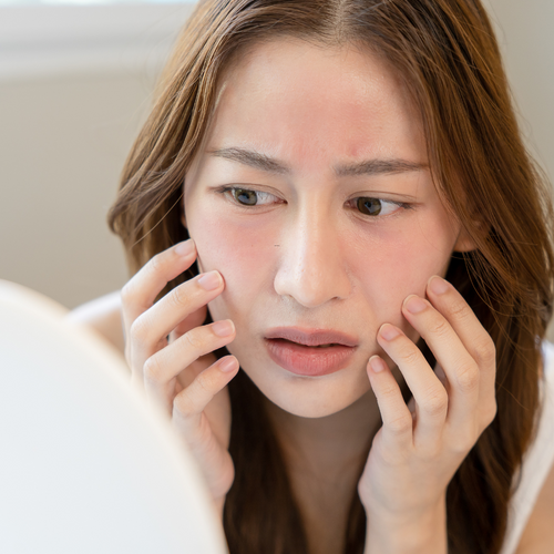 Soothing care for sensitive skin By BNB Derma 